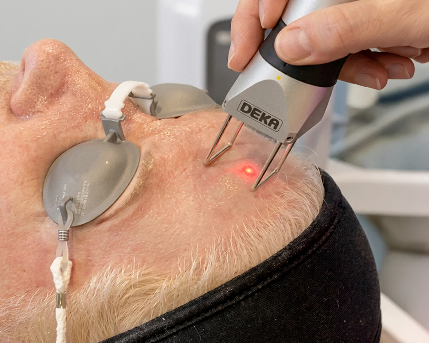 Láser CO₂ Deka · Haut Klinik