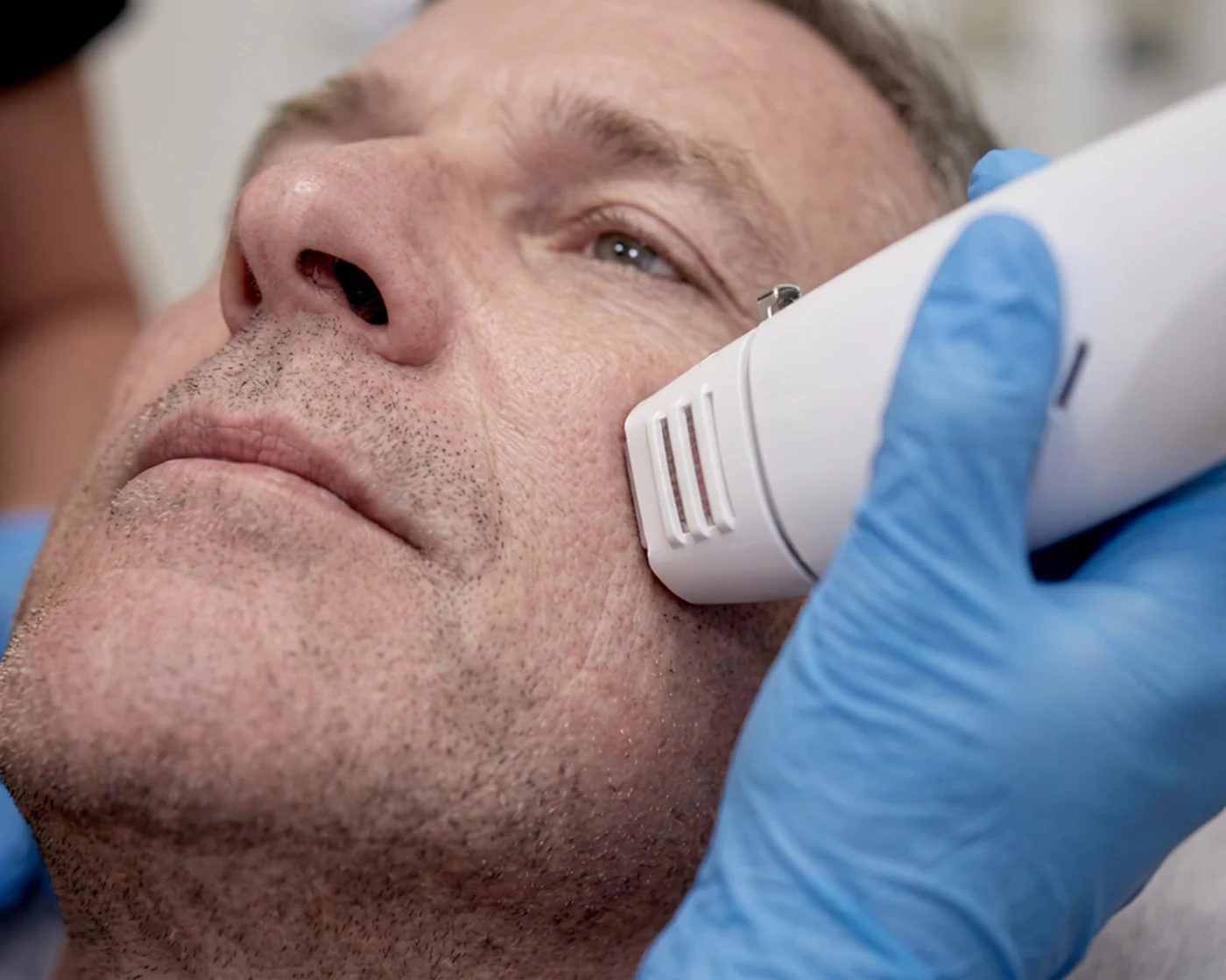 Liftera + Coolfase · Haut Klinik