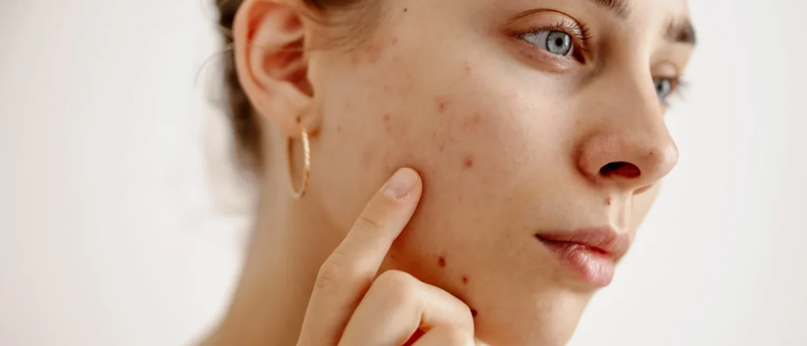 Haut Klinik · #TuPielTuHistoria