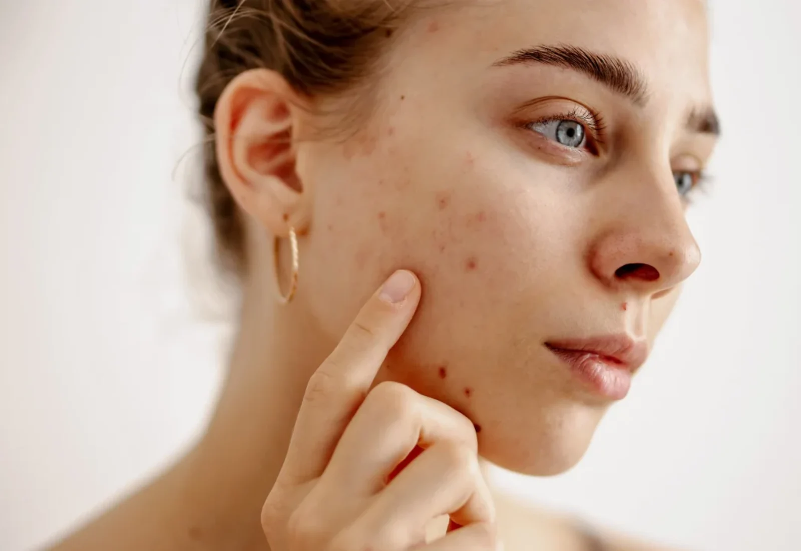 Haut Klinik · #TuPielTuHistoria