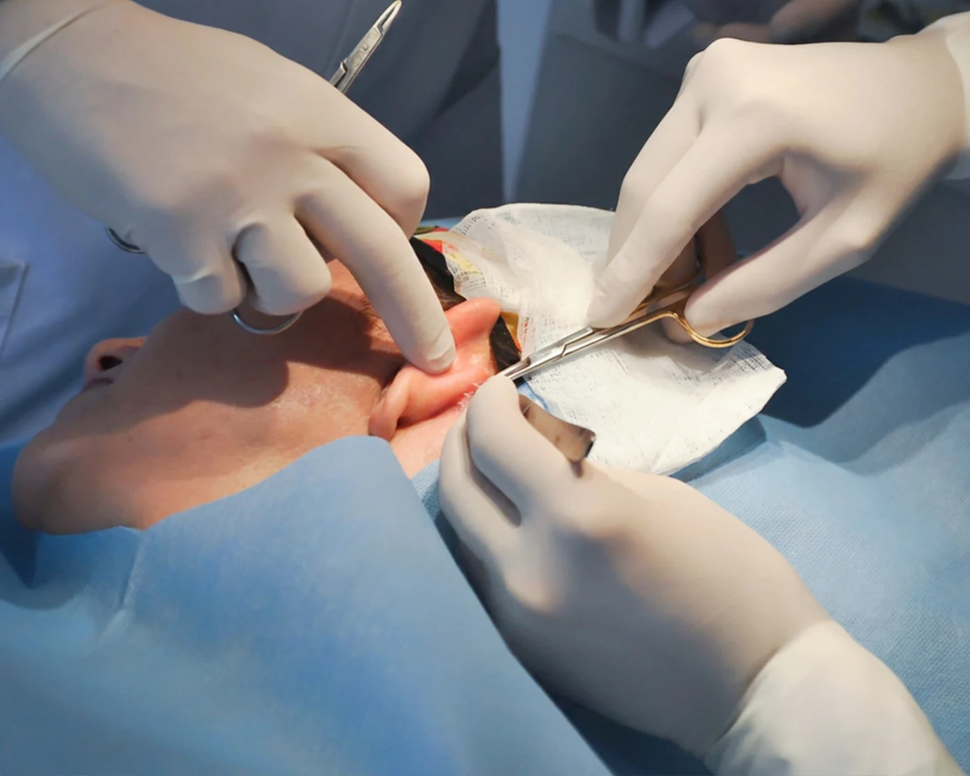 Fibroblastos FCells · Haut Klinik