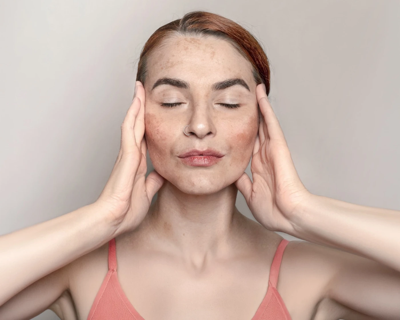 Manchas y pigmentación · Haut Klinik