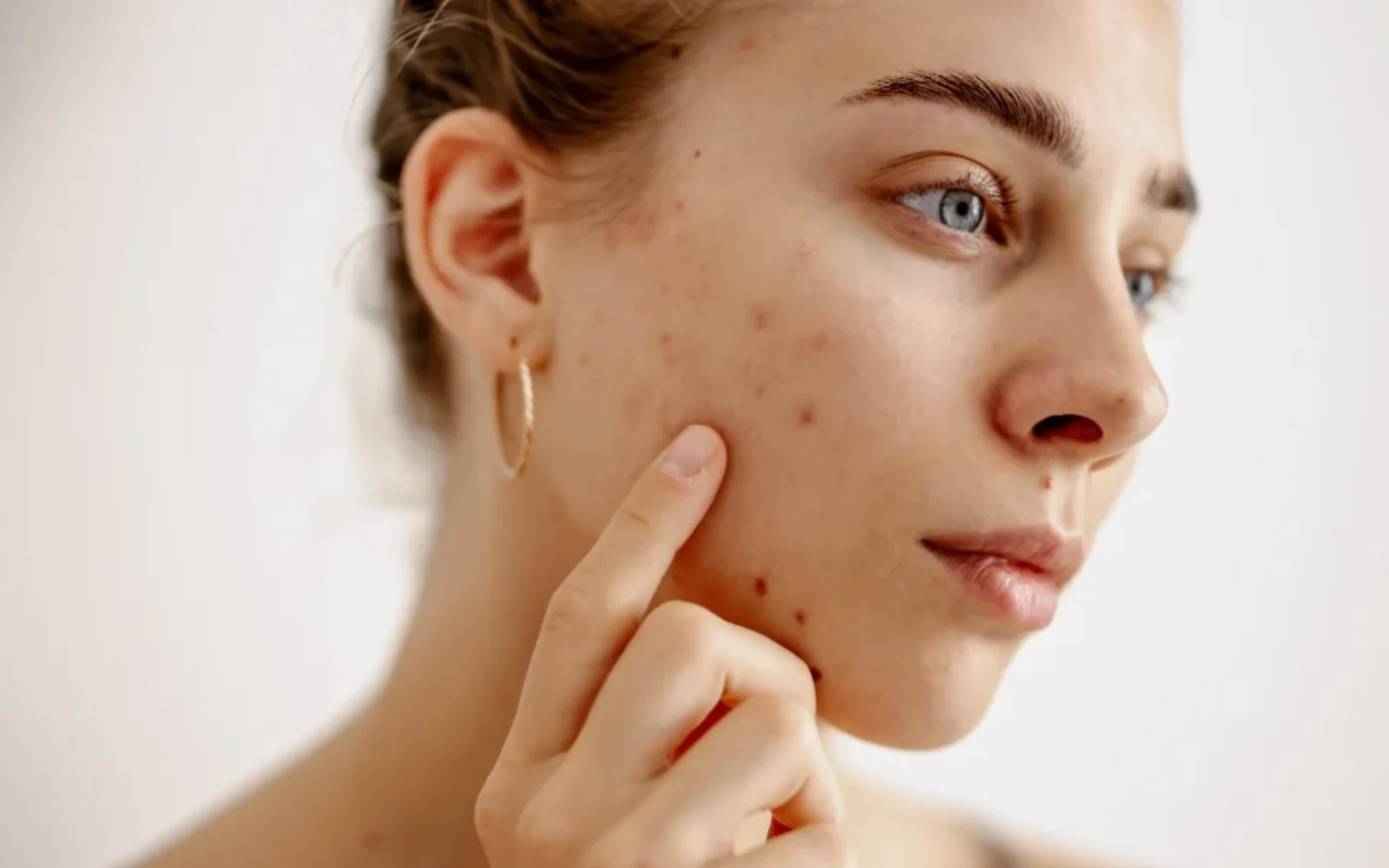 Haut Klinik · #TuPielTuHistoria